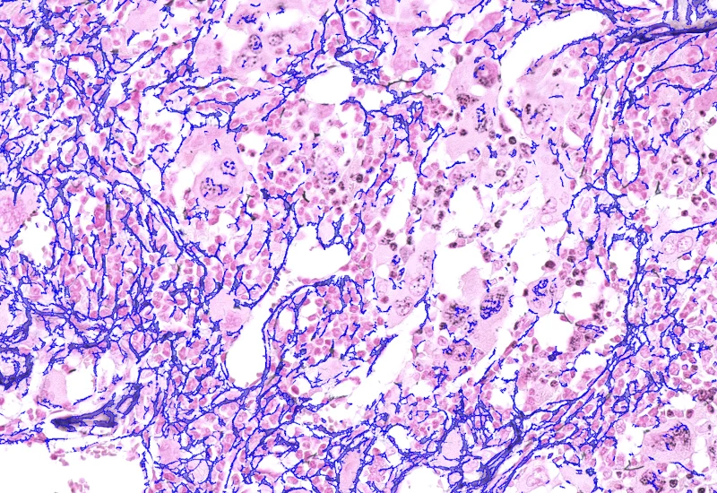 Dynamic Content Image